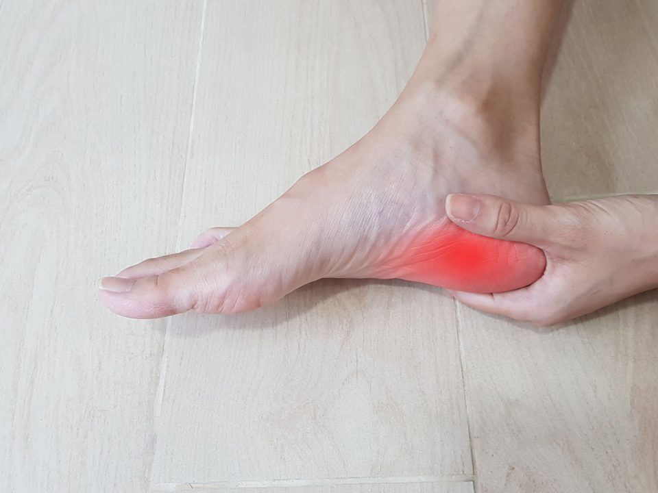 Plantar Fasciitis