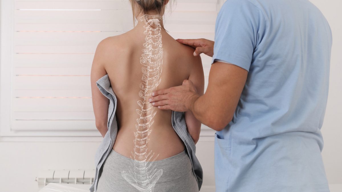 Scoliosis