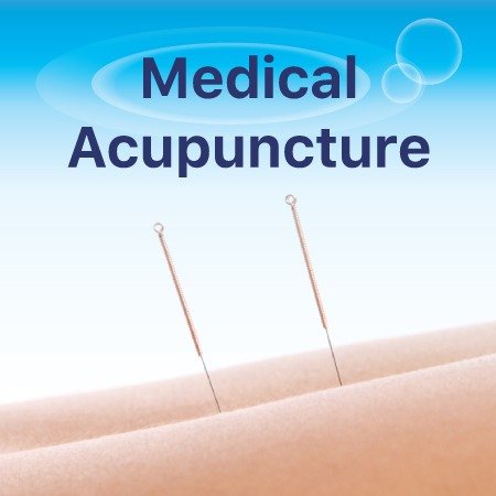 Acupunture