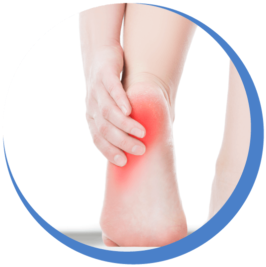 Plantar Fasciitis Treatments