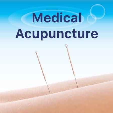 Medical Acupuncture