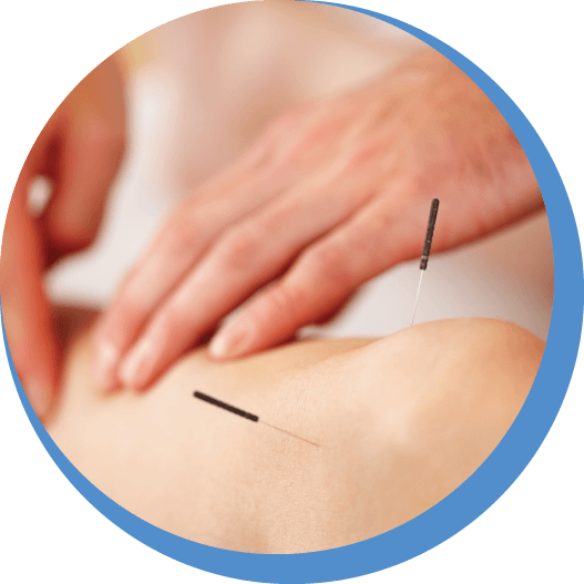 Acupuncture Treatment In Ashford